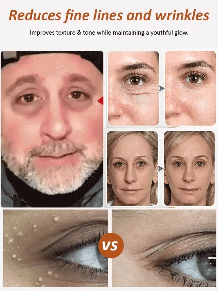 Last Day Of Discount 🔥 Anti Aging Eye Cream 💧