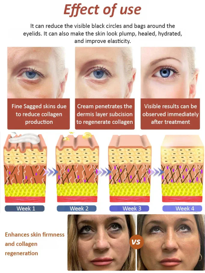 Last Day Of Discount 🔥 Anti Aging Eye Cream 💧