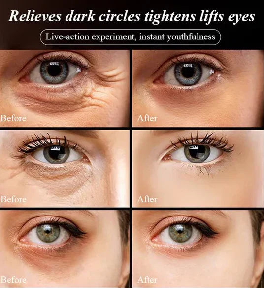 Last Day Of Discount 🔥 Anti Aging Eye Cream 💧